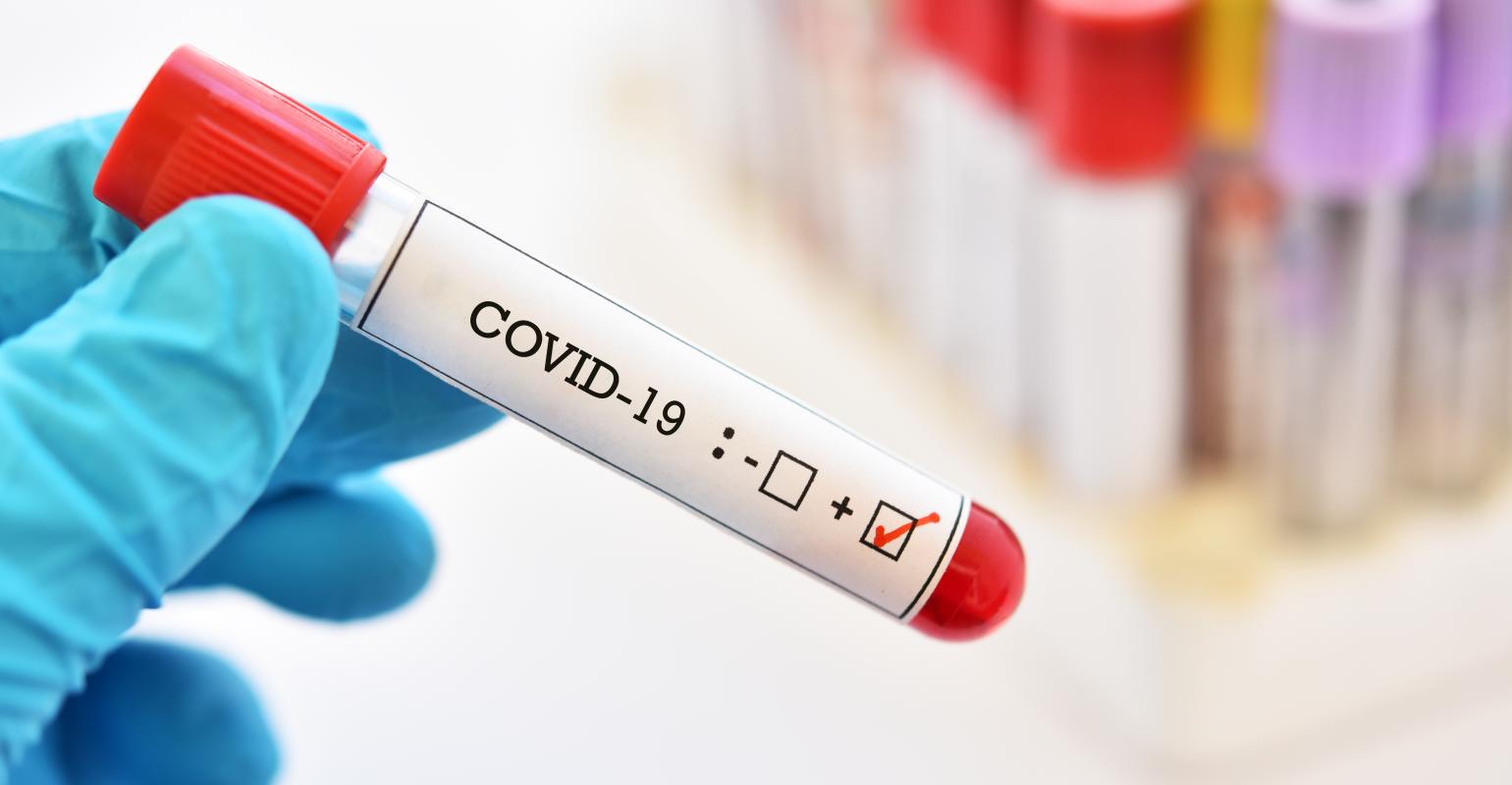 Coronavirus Caution Slowly Grows in the CRE Market